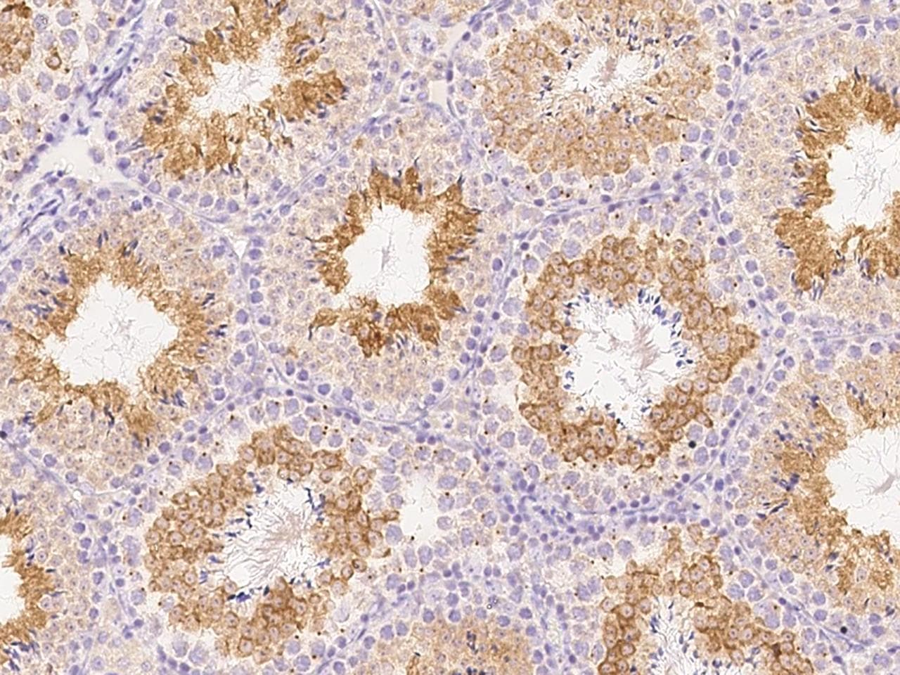 ANGEL1 Antibody