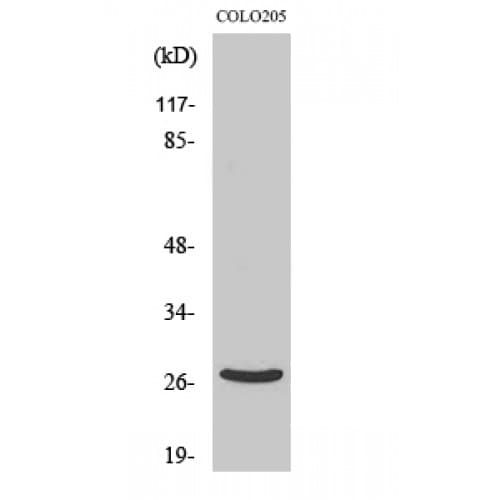 DHRS2 / HEP27 Antibody (80-160 aa, Internal)