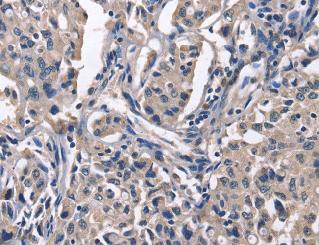 PEBP1 / RKIP Antibody