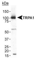 TRPA1 Antibody (N-Terminus, DY488)