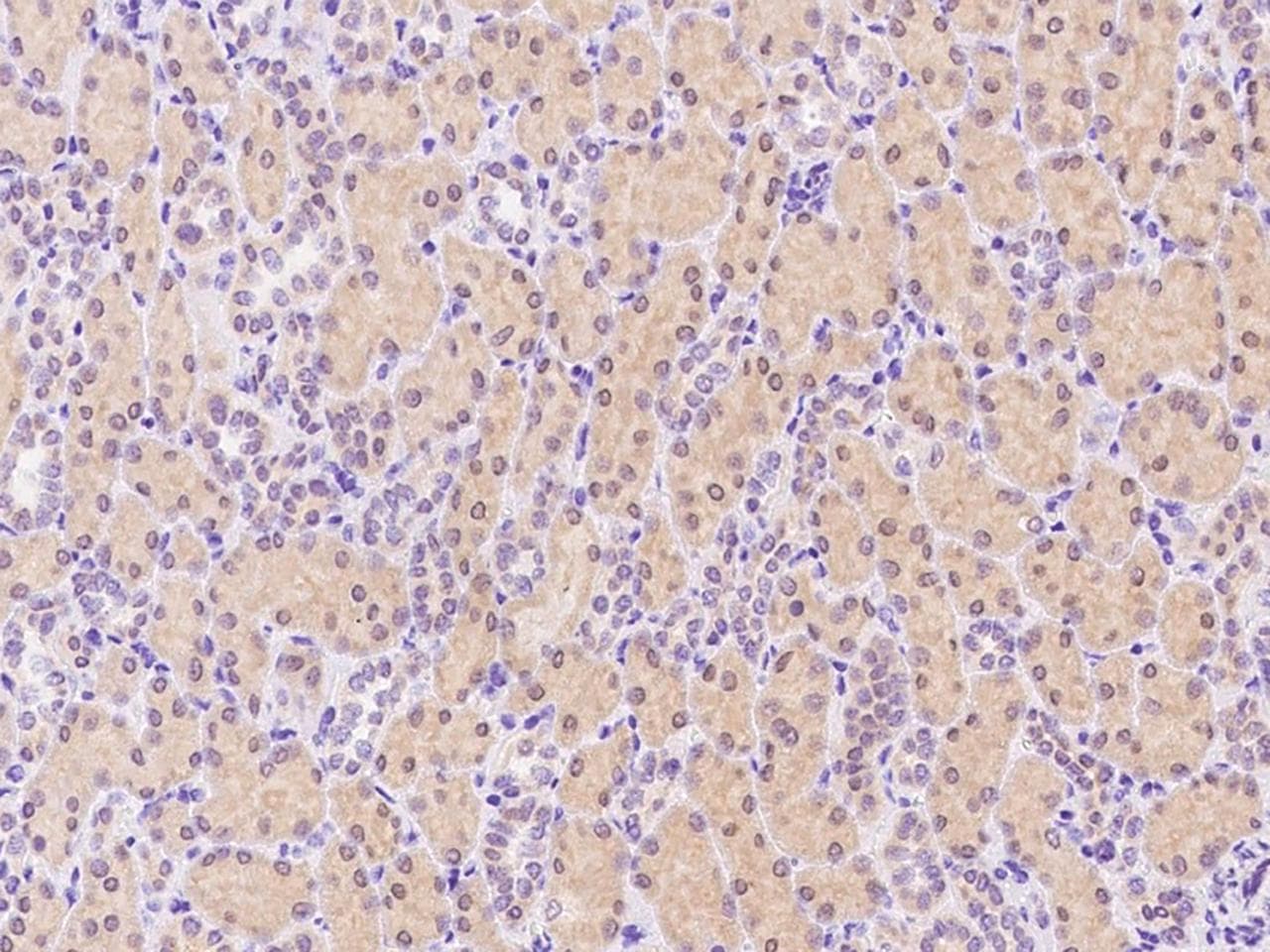 IFN Gamma / Interferon Gamma Antibody (Preservative Free)