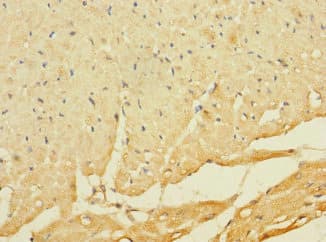 C8orf74 Antibody