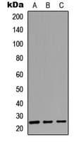 CABP2 Antibody (Internal)