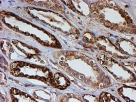 PSMB9 Antibody (aa21-219, clone OTI1D1)