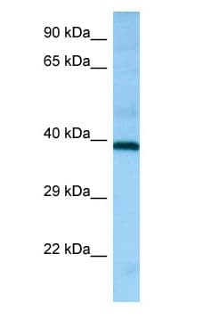 Polyclonal Rabbit anti-Human HRH2 / Histamine H2 Receptor Antibody (C-Terminus, WB)