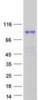 Human TIAM2 Protein (Recombinant Myc-DDK (Flag))