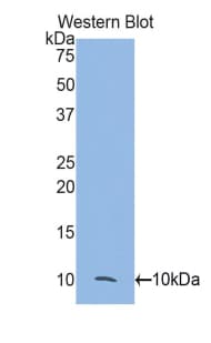 CTSD / Cathepsin D Antibody (aa54-121)