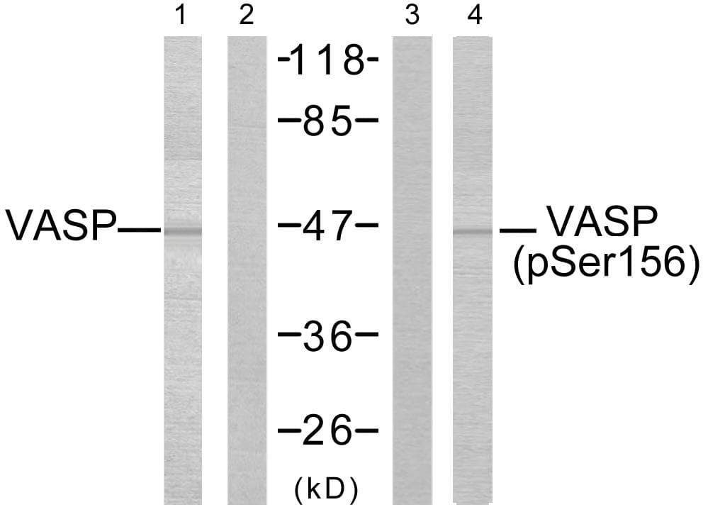 VASP Antibody (phospho-Ser157)