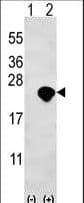 BID Antibody (aa68-103)