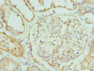 Polyclonal Rabbit anti-Human KLK4 / Kallikrein 4 Antibody (IHC)