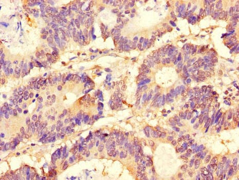 SLC37A1 Antibody