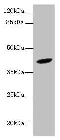 IHC-plus™ Polyclonal Rabbit anti-Human HM13 / IMP-1 / SPP Antibody (IHC, WB)