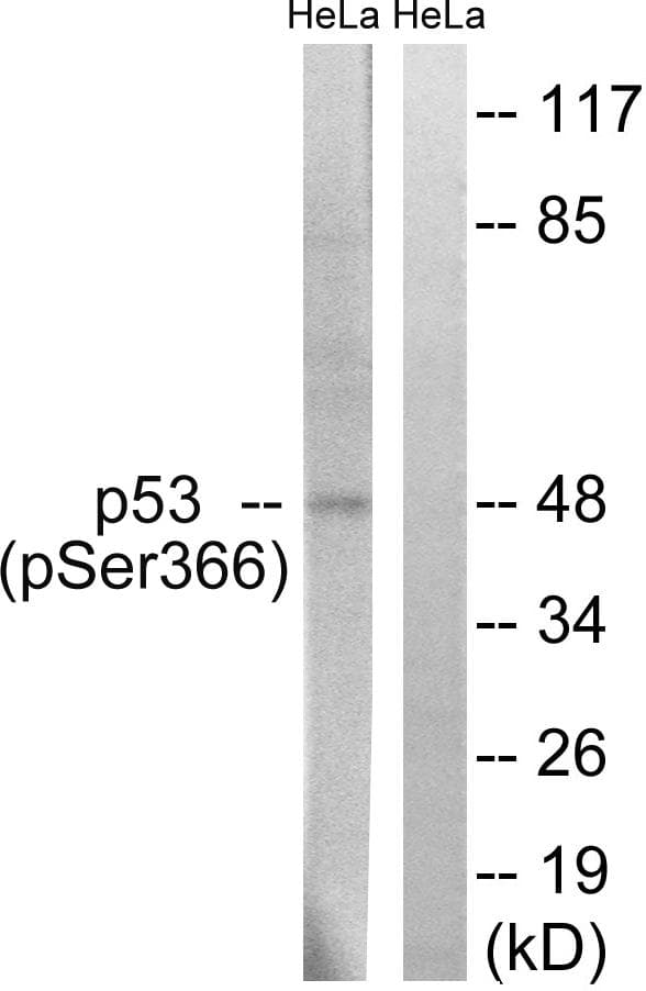 Polyclonal Rabbit anti-Human TP53 / p53 Antibody (phospho-Ser366, IHC, WB)