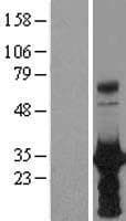 HOXB6 Protein (Over-Expression Lysate Myc-DDK (Flag))