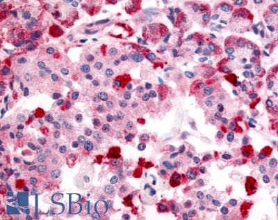 IHC-plus™ Polyclonal Rabbit anti-Human TRPM4 Antibody (Internal, IHC)