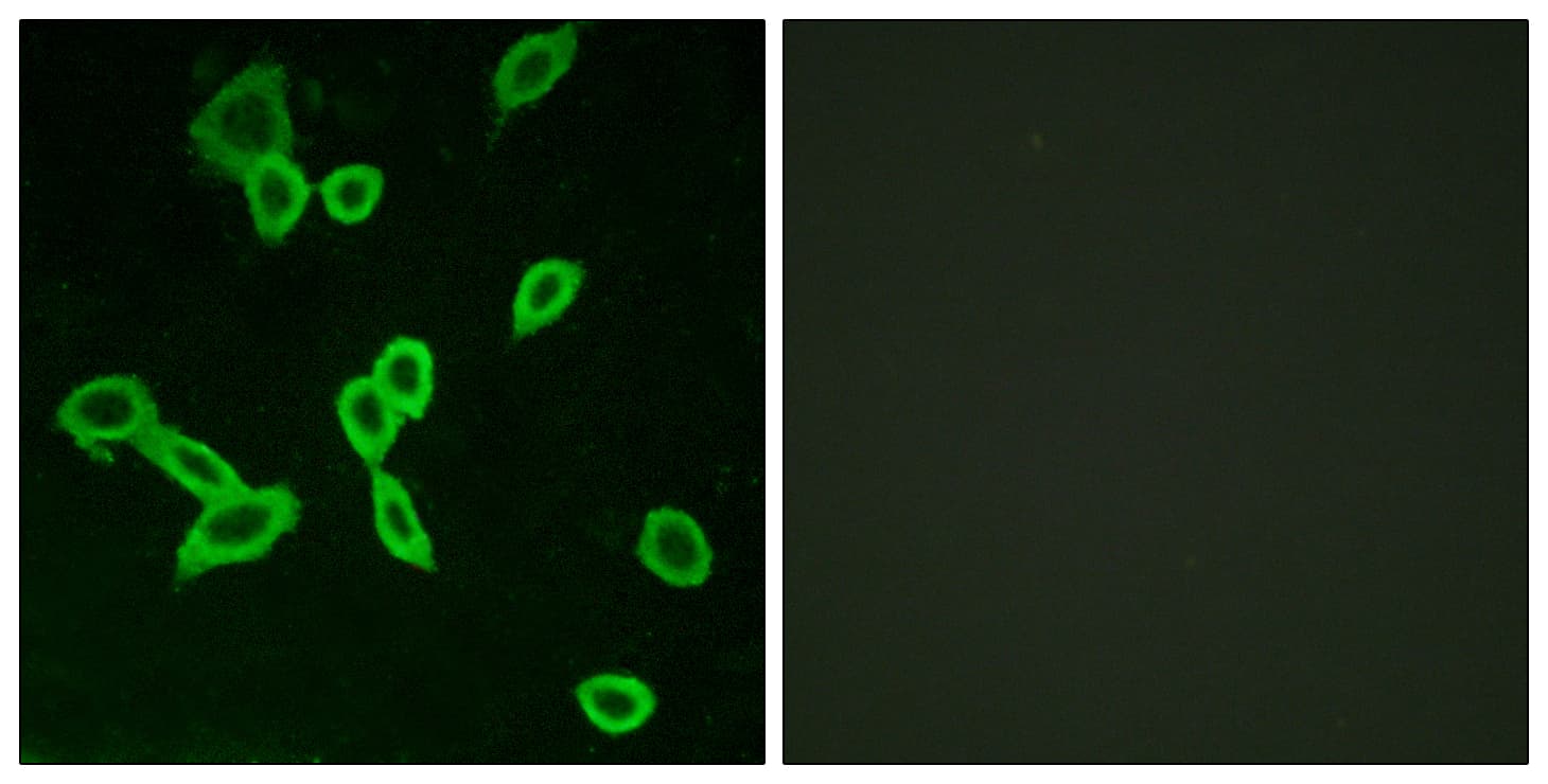 Polyclonal Rabbit anti-Human LGR6 Antibody (aa471-520, IF, WB)