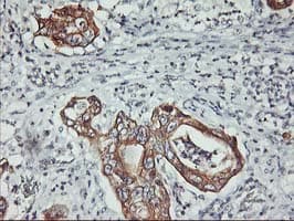 Monoclonal Mouse anti-Human PDSS2 / DLP1 Antibody (clone OTI1E9, IHC, IF, WB)