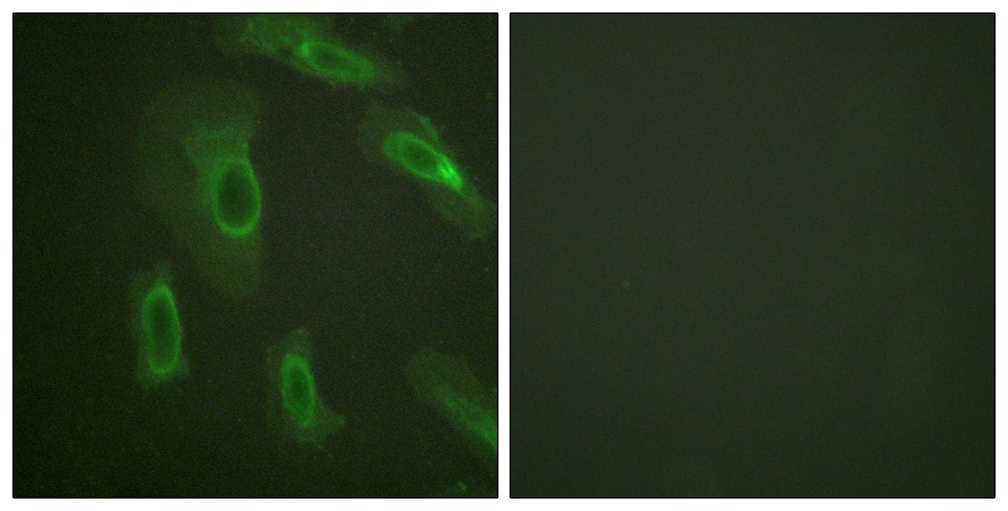 EMA / MUC1 Antibody (Ab-1243)