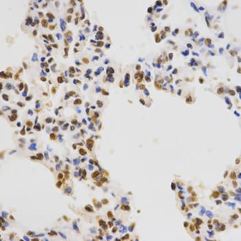 Polyclonal Rabbit anti-Human Histone H3 Antibody (Tri-Methyl-Lys36, IHC, IF, WB)