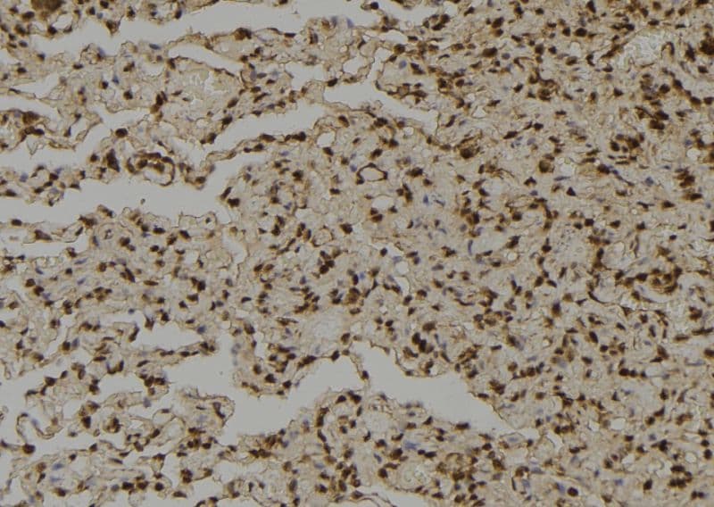 SHMT / SHMT2 Antibody