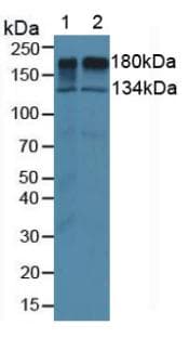 EGFR Antibody (aa713-984, APC)
