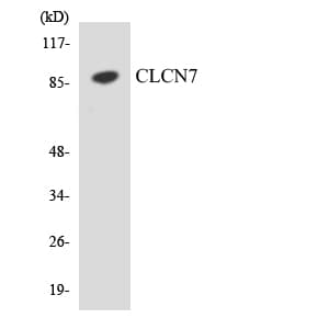 IHC-plus™ Polyclonal Rabbit anti-Human CLC-7 / CLCN7 Antibody (aa23-72, IHC, WB)