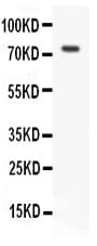 RIPK1 / RIP Antibody (aa411-425)