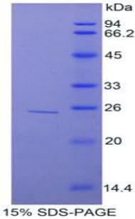 Rat TNIP2 / ABIN-2 Protein (Recombinant His-T7)