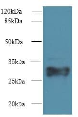 IHC-plus™ Polyclonal Rabbit anti-Human HLA-DRB4 Antibody (IHC, WB)