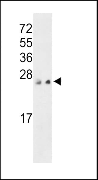 PTP4A3 Antibody (aa135-164)