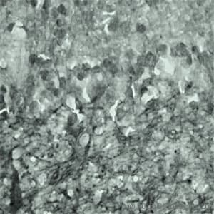 Polyclonal Rabbit anti-Human SYT17 Antibody (Internal, IHC, WB)