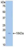 CST3 / Cystatin C Antibody (aa21-140, Biotin)