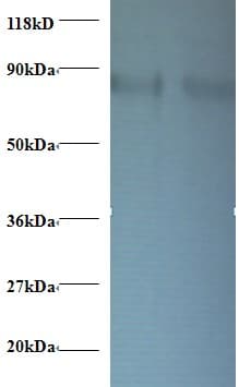 RPS10 / Ribosomal Protein S10 Antibody