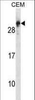 RGS5 Antibody (aa24-53)