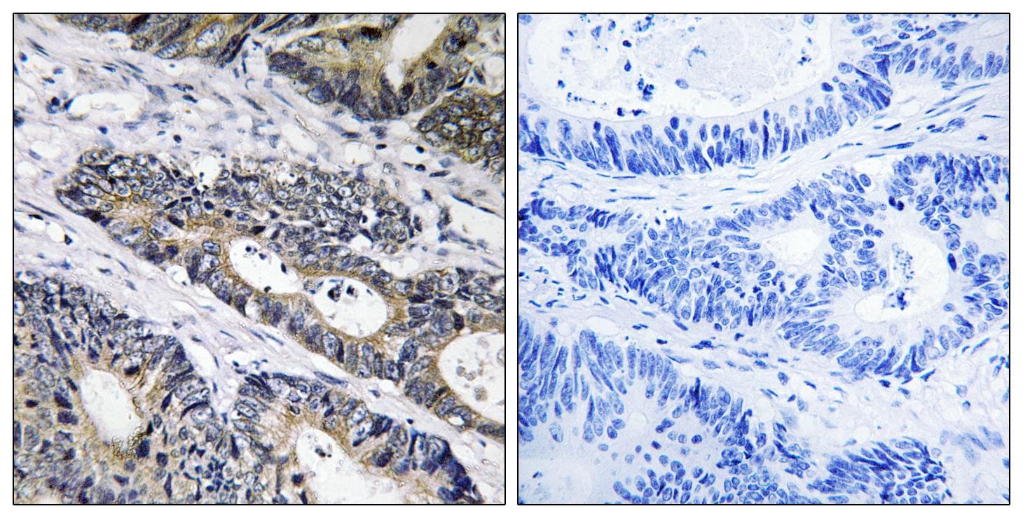 GLB1L3 Antibody
