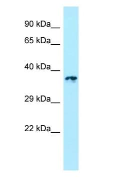 Polyclonal Rabbit anti-Human LTB4R2 / BLT2 Antibody (aa283-332, WB)