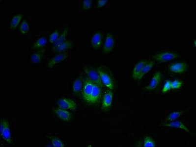 FAM70A Antibody