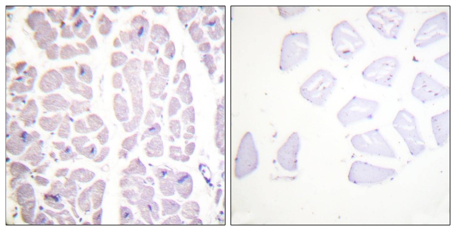 CHUK / IKKA / IKK Alpha Antibody (phospho-Ser180/181)
