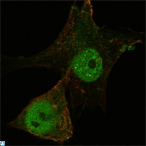 FOXP3 Antibody