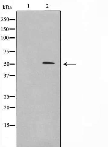 MEN1 / Menin Antibody
