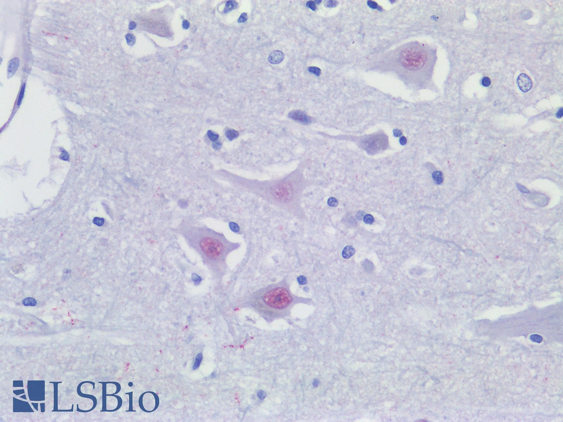 IHC-plus™ Polyclonal Rabbit anti-Human ATG16L1 / ATG16L Antibody (IHC, IF, WB)