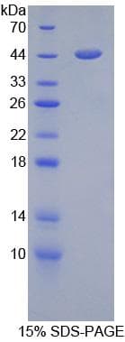 Mouse GFAP Protein (Recombinant His-GST)