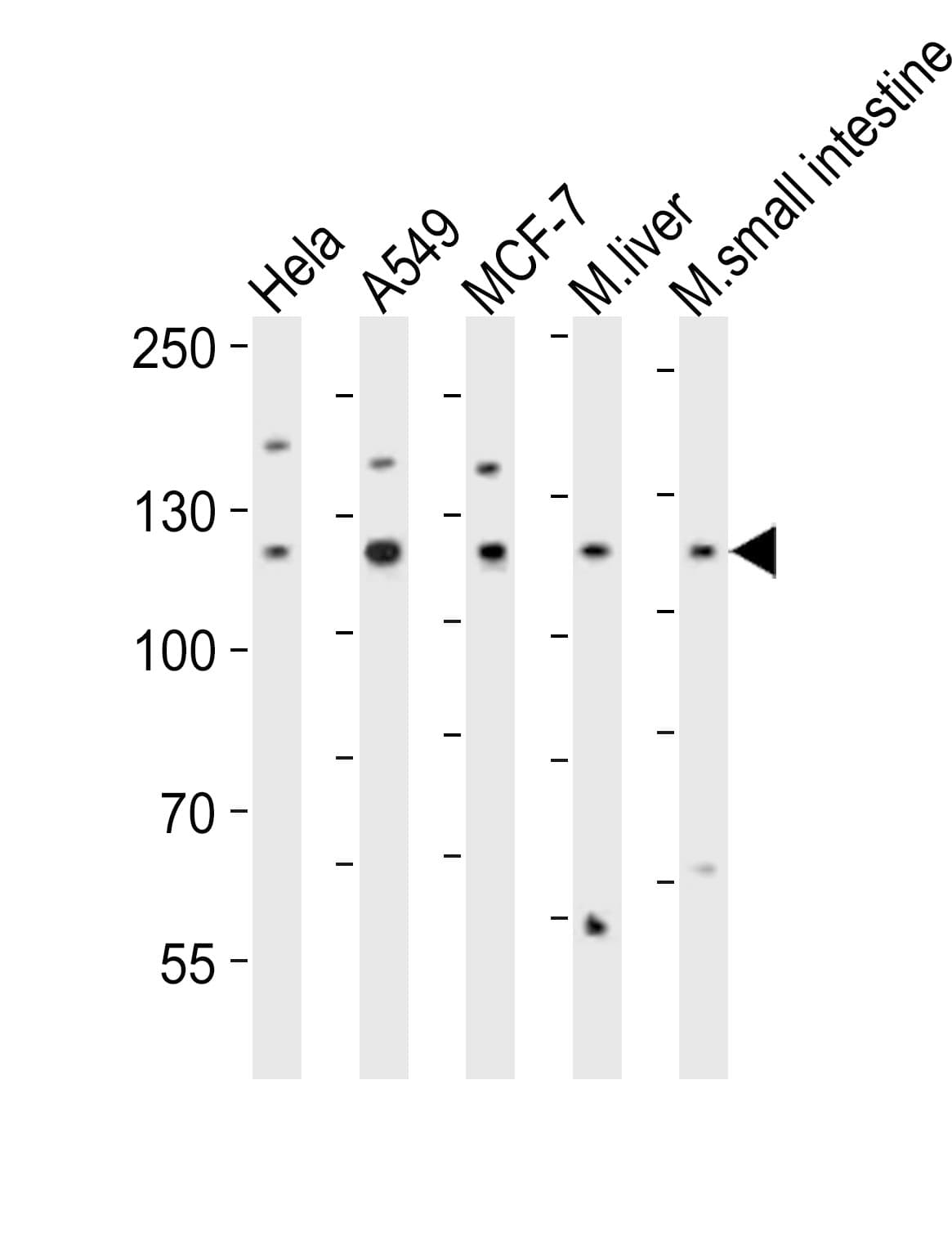 ZNF281 / Zfp281 Antibody (aa416-450)