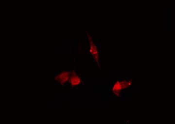 SLC30A8 / ZNT8 Antibody