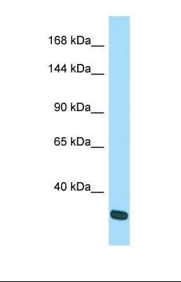 Polyclonal Rabbit anti-Human SRGAP3 Antibody (aa213-262, WB)