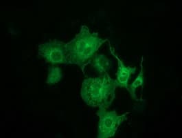MTMR14 Antibody (clone OTI6F8)