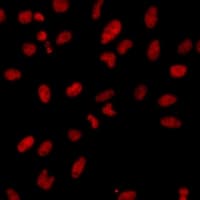 Polyclonal Rabbit anti-Human POLR2F Antibody (IF, WB)