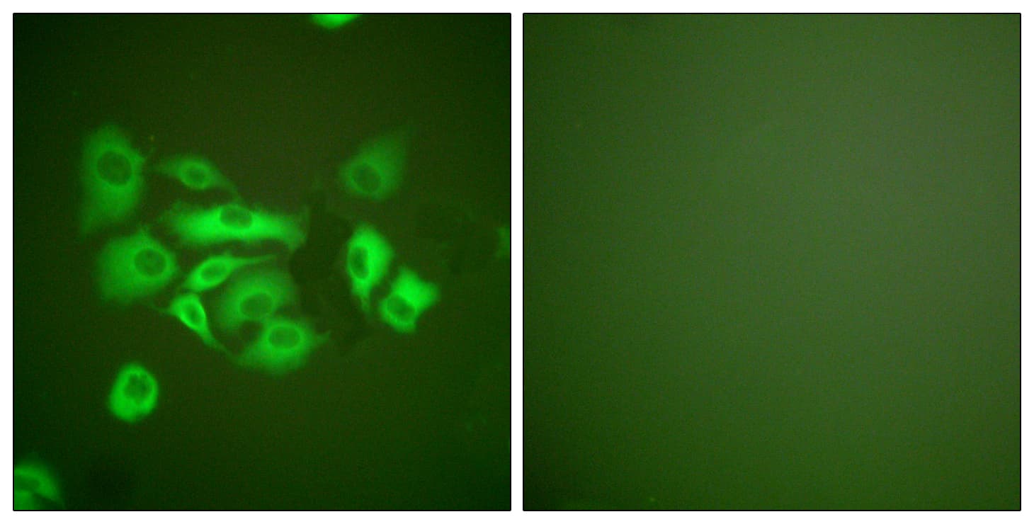 IHC-plus™ KRT10 / CK10 / Cytokeratin 10 Antibody (aa136-185)