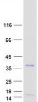 Human OLIG3 Protein (Recombinant Myc-DDK (Flag))