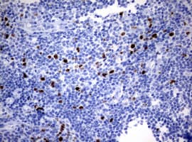 Monoclonal Mouse anti-Human MKI67 / Ki67 Antibody (clone OTI14G1, aa1160-1493, IHC)